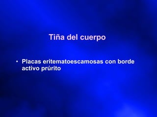 Tiña del cuerpo Placas eritematoescamosas con borde activo prúrito 