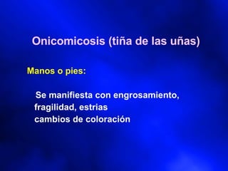 Onicomicosis (tiña de las uñas) Manos o pies: Se manifiesta con engrosamiento, fragilidad, estrias cambios de coloración 