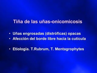 Tiña de las uñas-onicomicosis Uñas engrosadas (distróficas) opacas Afección del borde libre hacia la cutícula Etiología. T.Rubrum, T. Mentagrophytes 