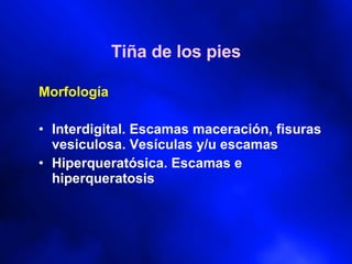 Tiña de los pies Morfología Interdigital. Escamas maceración, fisuras vesiculosa. Vesículas y/u escamas Hiperqueratósica. Escamas e hiperqueratosis 