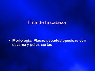 Tiña de la cabeza Morfología: Placas pseudoalopecicas con escama y pelos cortos 