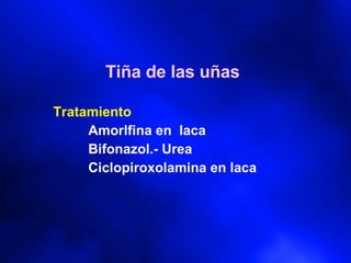 Tiña de las uñas Tratamiento Amorlfina en  laca Bifonazol.- Urea Ciclopiroxolamina en laca   