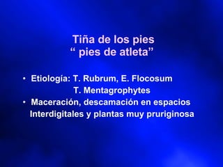 Tiña de los pies “ pies de atleta”  Etiología: T. Rubrum, E. Flocosum T. Mentagrophytes Maceración, descamación en espacios Interdigitales y plantas muy pruriginosa 