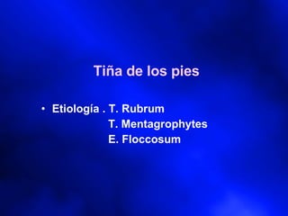 Tiña de los pies Etiología . T. Rubrum   T. Mentagrophytes   E. Floccosum 