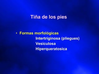 Tiña de los pies Formas morfológicas Intertriginosa (pliegues) Vesiculosa Hiperqueratosica 