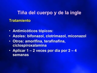 Tiña del cuerpo y de la ingle Tratamiento  Antimicóticos tópicos: Azoles: bifonazol, clotrimazol, miconazol Otros: amorlfina, terafinafina, ciclospiroxalamina Aplicar 1 – 2 veces por día por 2 – 4 semanas 