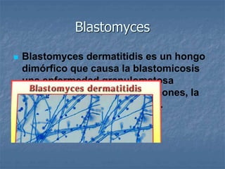 Blastomyces
 Blastomyces dermatitidis es un hongo
dimórfico que causa la blastomicosis
una enfermedad granulomatosa
crónica que afecta a los pulmones, la
piel y los huesos, entre otros.
 