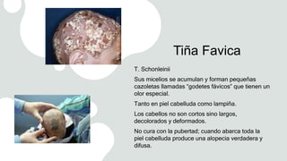 Tiña Favica
T. Schonleinii
Sus micelios se acumulan y forman pequeñas
cazoletas llamadas “godetes fávicos” que tienen un
olor especial.
Tanto en piel cabelluda como lampiña.
Los cabellos no son cortos sino largos,
decolorados y deformados.
No cura con la pubertad; cuando abarca toda la
piel cabelluda produce una alopecia verdadera y
difusa.
 