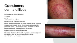 Granulomas
dermatofilicos
Condiciones de inmunodepresión
T rubrum
Mas frecuente en mujeres
Piel lampiña, M. inferiores (piernas)
Placas eritematoescamosas de bordes activos, en una segunda
fase aparecen nódulos duros, bien limitados, dolorosos, que
pronto se ulceran o fistulizan, con lo que dejan salir exudado
purulento donde es posible encontrar los hongos.
Cuadro crónico / tx antimicóticos orales
El examen directo y sobre todo la biopsia son necesarias para el
diagnóstico, pues el cuadro puede confundirse con
esporotricosis o tuberculosis.
 