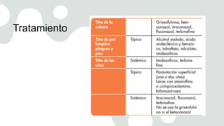 Tratamiento
 