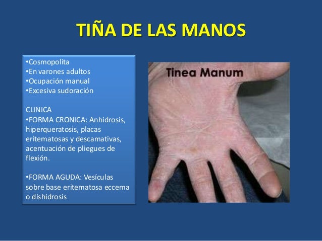 Los tratamientos de la psoriasis en eyske