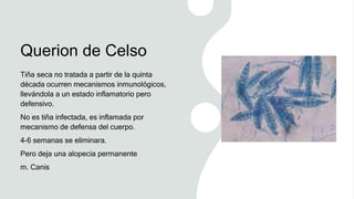 Querion de Celso
Tiña seca no tratada a partir de la quinta
década ocurren mecanismos inmunológicos,
llevándola a un estado inflamatorio pero
defensivo.
No es tiña infectada, es inflamada por
mecanismo de defensa del cuerpo.
4-6 semanas se eliminara.
Pero deja una alopecia permanente
m. Canis
 