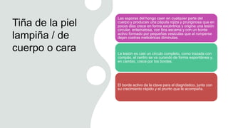 Tiña de la piel
lampiña / de
cuerpo o cara
Las esporas del hongo caen en cualquier parte del
cuerpo y producen una pápula rojiza y pruriginosa que en
pocos días crece en forma excéntrica y origina una lesión
circular, eritematosa, con fina escama y con un borde
activo formado por pequeñas vesículas que al romperse
dejan costras melicéricas diminutas.
La lesión es casi un círculo completo, como trazada con
compás, el centro se va curando de forma espontánea y,
en cambio, crece por los bordes.
El borde activo da la clave para el diagnóstico, junto con
su crecimiento rápido y el prurito que le acompaña.
 