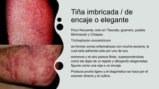 Tiña imbricada / de
encaje o elegante
Poco frecuente, solo en Tlaxcala, guerrero, puebla
Michoacán y Chiapas.
Trichophyton concentricum
se forman zonas eritematosas con mucha escama, la
cual está adherida sólo por uno de sus
extremos y el otro parece flotar, superponiéndose
como las tejas de un tejado y dibujando abigarradas
figuras como una reja o un encaje.
Produce prurito ligero y el diagnóstico se hace por el
examen directo y el cultivo.
 