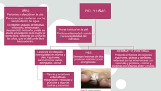 UÑAS
Perionixis y afección en la uña.
Personas que mantienen mucho
tiempo dentro del agua.
El reborde ungueal se observa
inflamado, eritematoso,
desprendido de la uña, y ésta se
afecta empezando de la matriz al
borde libre, diferente de la tiña de
las uñas, que es del borde libre
hacia adentro.
PIEL Y UÑAS
Lesiones en pliegues:
interdigitales en manos y
pies, inguinales,
submamarios, axilas,
interglúteo, periné
Fisuras y erosiones
eritematosas,
maceración, vesículas y
pústulas y algunas
costras y escamas.
PIES
Semejan lesiones de tiña,
producen mal olor y son
pruriginosas.
DERMATITIS POR PAÑAL
Presenta entonces en regiones
inguinales, glúteas y genitales,
extensas zonas eritematosas con
vesículas y pústulas, costras y
escamas con intenso ardor y prurito.
No es habitual en la piel.
Produce enfermedad cuando
la susceptibilidad del
individuo.
 