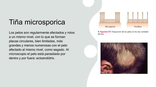 Tiña microsporica
Los pelos son regularmente afectados y rotos
a un mismo nivel, con lo que se forman
placas circulares, bien limitadas, más
grandes y menos numerosas con el pelo
afectado al mismo nivel, como segado. Al
microscopio el pelo está parasitado por
dentro y por fuera: ectoendótrix.
 