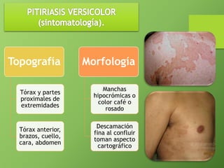 Topografía 
Tórax y partes 
proximales de 
extremidades 
Tórax anterior, 
brazos, cuello, 
cara, abdomen 
Morfología 
Manchas 
hipocrómicas o 
color café o 
rosado 
Descamación 
fina al confluir 
toman aspecto 
cartográfico 
 