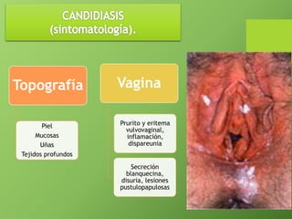 Vagina 
Prurito y eritema 
vulvovaginal, 
inflamación, 
dispareunia 
Secreción 
blanquecina, 
disuria, lesiones 
pustulopapulosas 
Topografía 
Piel 
Mucosas 
Uñas 
Tejidos profundos 
 