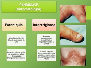 Paroniquia 
Afección del tejido 
blando que rodea la 
uña 
Eritema, edema, dolor 
en ocasiones, salida 
de exudado 
blanquecino purulento 
Intertriginosa 
Regiones 
submamarias, 
interdifitales, 
inguinocreurales y 
axilas 
Eritema intenso, 
lesiones puntiformes 
satelites, maceracion, 
placas blanquecinas y 
fisuras 
 