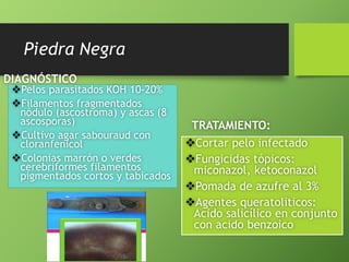Piedra Negra 
DIAGNÓSTICO 
TRATAMIENTO: 
Cortar pelo infectado 
Fungicidas tópicos: 
miconazol, ketoconazol 
Pomada de azufre al 3% 
Agentes queratoliticos: 
Acido salicílico en conjunto 
con acido benzoico 
Pelos parasitados KOH 10-20% 
Filamentos fragmentados 
nódulo (ascostroma) y ascas (8 
ascosporas) 
Cultivo agar sabouraud con 
cloranfenicol 
Colonias marrón o verdes 
cerebriformes filamentos 
pigmentados cortos y tabicados 
 