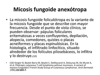Micosis fungoide anexótropa
• La micosis fungoide foliculótropa es la variante de
la micosis fungoide que se describe con mayor
frecuencia. Desde el punto de vista clínico, se
pueden observar: pápulas foliculares
eritematosas a veces confluyentes, depilación,
alopecia, comedones, quistes o placas
acneiformes y placas espinulósicas. En la
histología, el infiltrado linfocítico, situado
alrededor de los folículos pilosebáceos, lo infiltra
y lo destruye.(10)
• (10) Vergier B, Beylot-Barry M, Beylot C, DeMascarel A, Delaunay M, De Muret A,
et al. Pilotropic cutaneous T-cell lymphoma without mucinosis. A variant of
mycosis fungoides? French Study Group of Cutaneous Lymphomas. Arch Dermatol
1996;132:683-7.
 