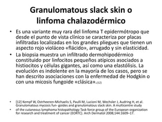 Granulomatous slack skin o
linfoma chalazodérmico
• Es una variante muy rara del linfoma T epidermótropo que
desde el punto de vista clínico se caracteriza por placas
infiltradas localizadas en los grandes pliegues que tienen un
aspecto rojo violáceo «flácido», arrugado y sin elasticidad.
• La biopsia muestra un infiltrado dermohipodérmico
constituido por linfocitos pequeños atípicos asociados a
histiocitos y células gigantes, así como una elastólisis. La
evolución es indolente en la mayoría de los casos, pero se
han descrito asociaciones con la enfermedad de Hodgkin o
con una micosis fungoide «clásica».(12)
• [12] Kempf W, Ostrheeren-Michaelis S, Paulli M, Lucioni M, Wechsler J, Audring H, et al.
Granulomatous mycosis fun- goides and granulomatous slack skin. A multicentre study
• of the cutaneous lymphoma histopathology Task force group of the European organization
for research and treatment of cancer (EORTC). Arch Dermatol 2008;144:1609–17.
 