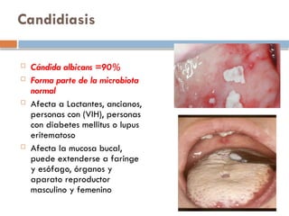 tipos de Micosis y tratamiento farmacológico | PPTX