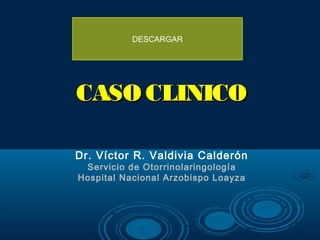 DESCARGAR




CASO CLINICO

Dr. Víctor R. Valdivia Calderón
 Servicio de Otorrinolaringología
Hospital Nacional Arzobispo Loayza
 