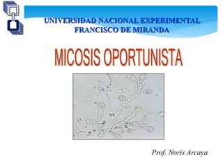 UNIVERSIDAD NACIONAL EXPERIMENTAL
FRANCISCO DE MIRANDA
Prof. Noris Arcaya
 