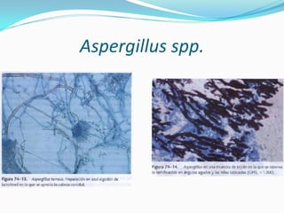 Aspergillus spp.  