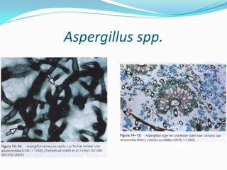Aspergillus spp.  
