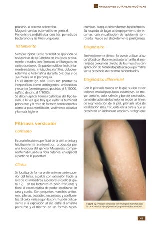 45
I nfecciones cutáneas micóticas
psoriasis, o eczema seborreico.
Muguet: con las estomatitis en general.
Perionixis-candidiásica con los panadizos
bacterianos y las tiñas ungueales.
Tratamiento
Siempre tópico. Existe facilidad de aparición de
resistencias de la Candida en los casos previa-
mente tratados con fármacos antifúngicos en
varias ocasiones. Se pueden utilizar indistinta-
mente nistatina, imidazoles, naftifina, ciclopiro-
xolamina o terbinafina durante 5-7 días y de
3-4 meses en la paroniquia.
En el intértrigo son útiles los productos
inespecíficos como astringentes, antisépticos
y secantes (permanganato potásico al 1/10000,
sulfato de cinc al 1/1000).
Se deben aplicar formas galénicas del tipo lo-
ción, a la vez que hay que evitar la humedad
persistente y el resto de factores condicionantes
como la poca ventilación, vestimenta oclusiva
y la mala higiene
Pitiriasis versicolor
Concepto
Es una infección superficial de la piel, crónica y
habitualmente asintomática, producida por
una levadura del género Malassezia, compo-
nente habitual de la flora cutánea, en especial
a partir de la pubertad
Clínica
Se localiza de forma preferente en parte supe-
rior del tórax, espalda con extensión hacia la
raíz de los miembros superiores y cuello (Figu-
ra 12) , en los lactantes es poco frecuente y
tiene la característica de poder localizarse en
cara y cuello. Son pequeñas manchas unifor-
mes, planas, ovaladas, escamosas y confluen-
tes. El color varía según la constitución del pa-
ciente y la exposición al sol, entre el amarillo
parduzco y el marrón en las formas hiper-
crómicas, aunque existen formas hipocrómicas.
Su raspado da lugar al despegamiento de es-
camas, con visualización de epidermis son-
rosada. Puede ser discretamente pruriginosa.
Diagnóstico
Eminentemente clínico. Se puede utilizar la luz
de Wood con fluorescencia del amarillo al ana-
ranjado o examen directo de las muestras con
aplicación de hidróxido potásico que permitirá
ver la presencia de racimos redondeados.
Diagnóstico diferencial
Con la pitiriasis rosada en la que suelen existir
lesiones maculopapulosas escamosas de ma-
yor tamaño, color salmón y bordes circinados,
con ordenación de las lesiones según las líneas
de segmentación de la piel, pitiriasis alba de
localización más frecuente en la cara y que se
presentan en individuos atópicos, vitíligo que
Figura 12. Pitiriasis versicolor con múltiples manchas con
la característica hipopigmentación y mínima descamación.
 