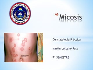 *
Dermatología Práctica
Martin Lescano Ruiz
7° SEMESTRE
 