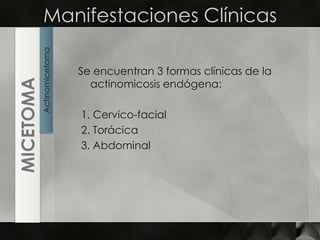 Manifestaciones ClínicasSe encuentran 3 formas clínicas de la actinomicosis endógena: 1. Cervico-facial2. Torácica3. AbdominalActinomicetomaMICETOMA