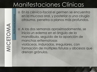 Manifestaciones ClínicasEn la cérvico-facial el germen se encuentra en la mucosa oral, y posterior a una cirugía otrauma, penetra a planos más profundos.A las dos semanas aproximadamente, se inicia un edema en el ángulo de la mandíbula, seguido de la aparición de  manchas eritematosas violáceas, induradas, irregulares, con formación de múltiples fístulas y abcesos que drenan gránulos.ActinomicetomaMICETOMA
