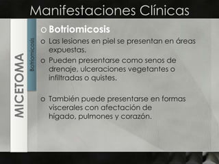 Manifestaciones ClínicasBotriomicosisLas lesiones en piel se presentan en áreas expuestas.Pueden presentarse como senos de drenaje, ulceraciones vegetantes o infiltradas o quistes.También puede presentarse en formas viscerales con afectación de hígado, pulmones y corazón.BotriomicosisMICETOMA