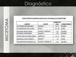 DiagnósticoMICETOMA