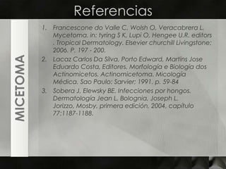 ReferenciasFrancescone do Valle C, Wolsh O, Veracabrera L. Mycetoma. in: tyring S K, Lupi O, Hengee U.R. editors . Tropical Dermatology. ElsevierchurchillLivingstone; 2006. P. 197 - 200.Lacaz Carlos Da Silva, Porto Edward, Martins Jose Eduardo Costa, Editores. Morfología e Biología dos Actinomicetos. Actinomicetoma. Micología Médica. Sao Paulo: Sarvier; 1991. p. 59-84Sobera J, Elewsky BE. Infecciones por hongos. Dermatología Jean L. Bolognia, Joseph L. Jorizzo, Mosby, primera edición, 2004, capítulo 77:1187-1188.MICETOMA