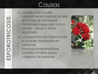 CausasLa infección ocurre comúnmente cuando la piel se rompe al manipular materiales vegetales como rosales, zarzas o tierra abonada.La esporotricosis diseminada se puede desarrollar en personas inmunocomprometidas cuando inhalan polvo cargado de esporas.ESPOROTRICOSIS