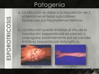 PatogeniaLa infección se debe a la inoculación de S. schenckii en el tejido subcutáneo favorecida por traumatismos mínimos. La infección puede limitarse al sitio de la inoculación (esporotricosisen placas) o propagarse proximalmente por los canales linfáticos (esporotricosislinfangítica).ESPOROTRICOSISEn placasLinfangítica