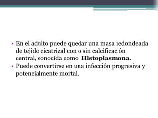 • En el adulto puede quedar una masa redondeada
  de tejido cicatrizal con o sin calcificación
  central, conocida como Histoplasmona.
• Puede convertirse en una infección progresiva y
  potencialmente mortal.
 