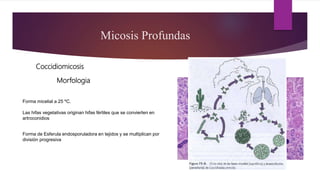 Micosis Profundas
Coccidiomicosis
Forma micelial a 25 ºC.
Las hifas vegetativas originan hifas fértiles que se convierten en
artroconidios
Forma de Esferula endosporuladora en tejidos y se multiplican por
división progresiva
Morfologia
 