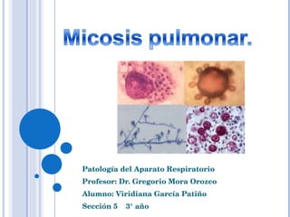 Patología del Aparato Respiratorio Profesor: Dr. Gregorio Mora Orozco Alumno: Viridiana García Patiño Sección 5  3° año 