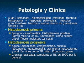 Patología y Clínica A las 3 semanas:  hipersesibilidad  retardada  frente al histoplasma  y  respuesta  patologica:  reaccion granulomatosa. Necrosis caseosa dentro de granulomas similar a TB.  Histoplasmosis primaria: Benigna y asintomatica. Histoplasmina positiva. Patron miliar a los Rx. Sintomatica: como cuadro gripal (fiebre, malestar, tos seca) Histoplasmosis progresiva: Aguda: diseminada, comprometido, anemia, leucopenia, hepatomegalia, granuloma mucocutaneo y oral. En ninos como TB miliar. Pronostico grave. Cronica: localizada, semejante a TB, en EPOC por lo general. 
