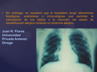 • Sin embrago, es necesario que el hospedero tenga alteraciones
fisiológicas, anatómicas o inmunológicas que permitan la
colonización de sus tejidos o la inducción del estado de
sensibilización alérgica iniciando un sindrome alergico.

Juan R. Flores
Universidad
Privada Antenor
Orrego

 