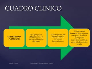 CUADRO CLINICO

ENFERMEDAD
PULMONAR

1) Aspergilosis
alérgica donde el
agente actúa como
alergeno.

2) Aspergilosis por
colonización de
cavidades
(aspergiloma).

3) Enfermedad
invasiva, la que puede
ser aguda o crónica:
Aspergilosis
necrotizante crónica,
aspergilosis invasiva
aguda.

 