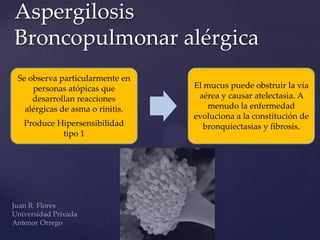 Aspergilosis
Broncopulmonar alérgica
Se observa particularmente en
personas atópicas que
desarrollan reacciones
alérgicas de asma o rinitis.
Produce Hipersensibilidad
tipo 1

El mucus puede obstruir la vía
aérea y causar atelectasia. A
menudo la enfermedad
evoluciona a la constitución de
bronquiectasias y fibrosis.

 