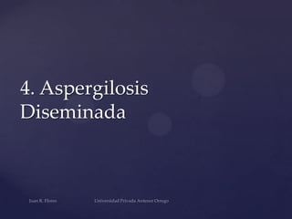 4. Aspergilosis
Diseminada

 