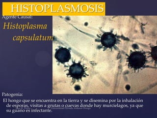 HISTOPLASMOSIS

Agente Causal:

Histoplasma
capsulatum

Patogenia:
El hongo que se encuentra en la tierra y se disemina por la inhalación
de esporas, visitas a grutas o cuevas donde hay murcielagos, ya que
su guano es infectante.

 