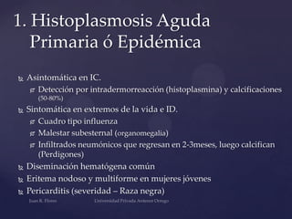 1. Histoplasmosis Aguda
Primaria ó Epidémica


Asintomática en IC.
 Detección por intradermorreacción (histoplasmina) y calcificaciones
(50-80%)








Sintomática en extremos de la vida e ID.
 Cuadro tipo influenza
 Malestar subesternal (organomegalia)
 Infiltrados neumónicos que regresan en 2-3meses, luego calcifican
(Perdigones)
Diseminación hematógena común
Eritema nodoso y multiforme en mujeres jóvenes
Pericarditis (severidad – Raza negra)

 